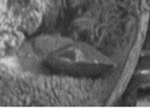 Разбор всех фотографий поисковиков группы Дятлова Разбор всех фотографий поисковиков группы Дятлова