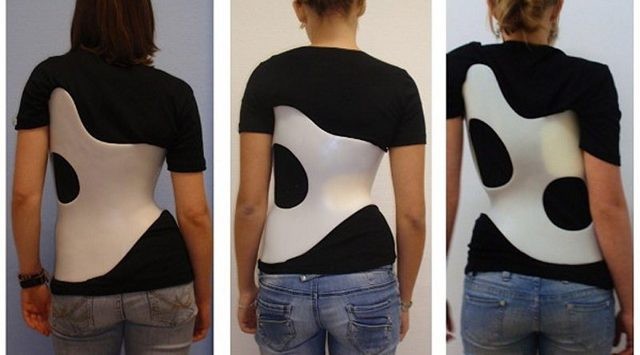 Сколиоз у детей: 12 причин появления, 5 ведущих симптомов, 5 методов лечения Сколиоз у детей: 12 причин появления, 5 ведущих симптомов, 5 методов лечения