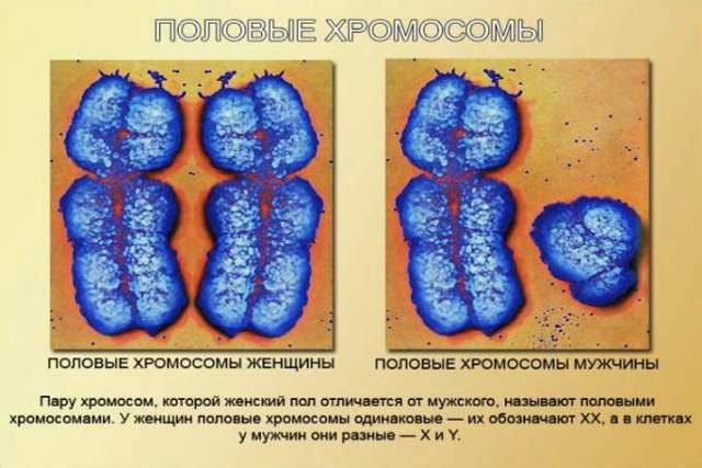 Синдром шерешевского тёрнера : 13 признаков генетического синдрома Синдром шерешевского тёрнера : 13 признаков генетического синдрома