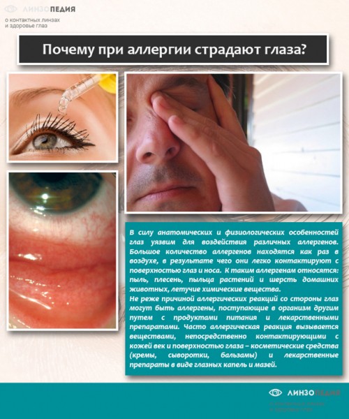 Синяки под глазами у ребенка: 12 возможных причин, методы лечения и профилактики Синяки под глазами у ребенка: 12 возможных причин, методы лечения и профилактики