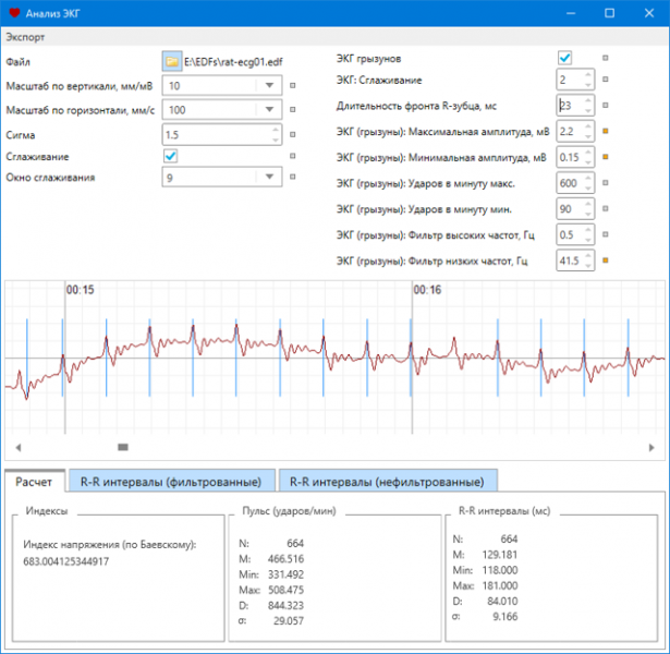Экг расшифровка у детей: 4 важных показания, норма и отклонения Экг расшифровка у детей: 4 важных показания, норма и отклонения
