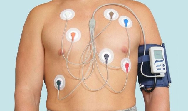 Экг расшифровка у детей: 4 важных показания, норма и отклонения Экг расшифровка у детей: 4 важных показания, норма и отклонения