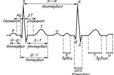 Экг расшифровка у детей: 4 важных показания, норма и отклонения Экг расшифровка у детей: 4 важных показания, норма и отклонения