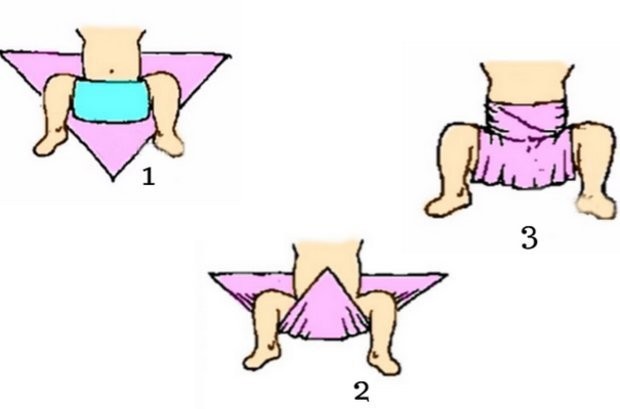 Широкое пеленание ребёнка: 2 показания, 4 способа, полезные советы