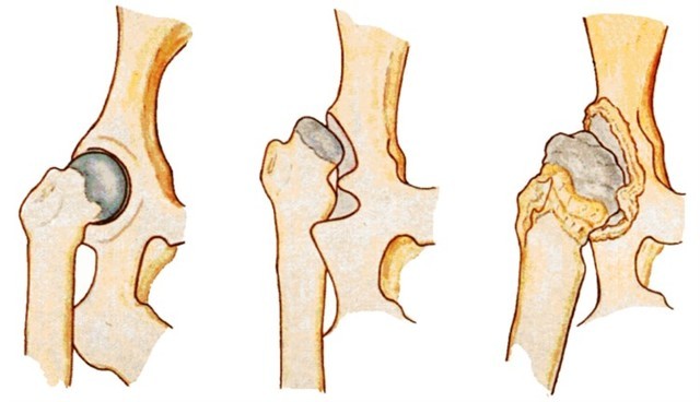 Широкое пеленание ребёнка: 2 показания, 4 способа, полезные советы