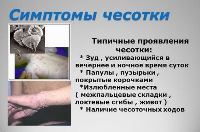 Чесотка у детей: причины, 2 основных формы, 14 принципов лечения, 5 групп препаратов