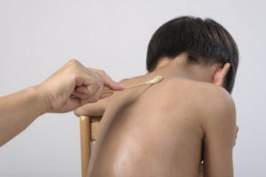 Чесотка у детей: причины, 2 основных формы, 14 принципов лечения, 5 групп препаратов