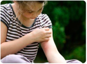 Чесотка у детей: причины, 2 основных формы, 14 принципов лечения, 5 групп препаратов