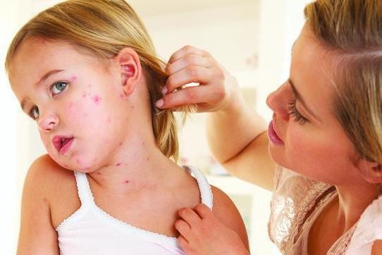 Чесотка у детей: причины, 2 основных формы, 14 принципов лечения, 5 групп препаратов
