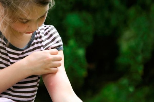 Чем лечить лишай у ребёнка: 6 основных принципов терапии Чем лечить лишай у ребёнка: 6 основных принципов терапии