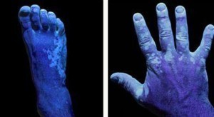 Чем лечить лишай у ребёнка: 6 основных принципов терапии Чем лечить лишай у ребёнка: 6 основных принципов терапии