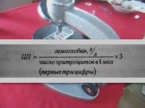 Цветовой показатель крови: причины повышенияи и 5 причин понижения уровня у детей, расшифровка результата