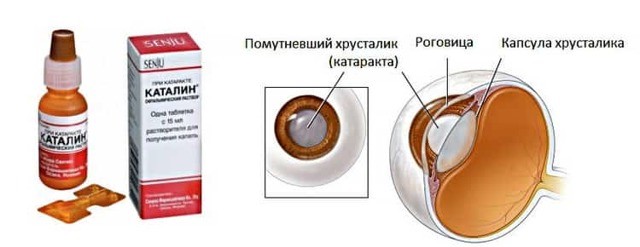 Альбуцид при насморке у детей: применение и эффективность, отзывы и мнение врача Альбуцид при насморке у детей: применение и эффективность, отзывы и мнение врача