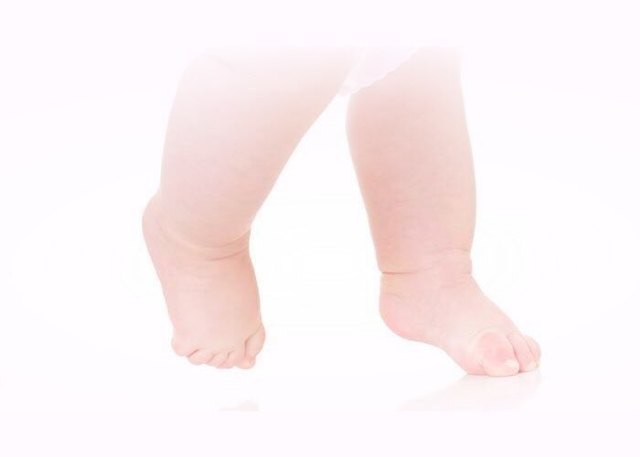 Ребенок ходит на носочках: 4 группы причин, лечение и что необходимо делать?