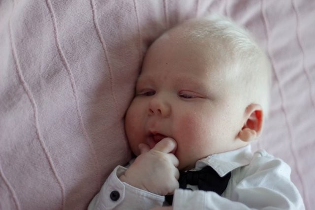 Альбинос: кто такой, 3 типа альбинизма, способы лечения и советы