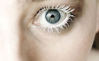 Альбинос: кто такой, 3 типа альбинизма, способы лечения и советы