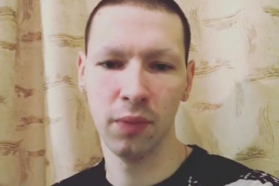 Кирилл Терешин показал руки после операции
