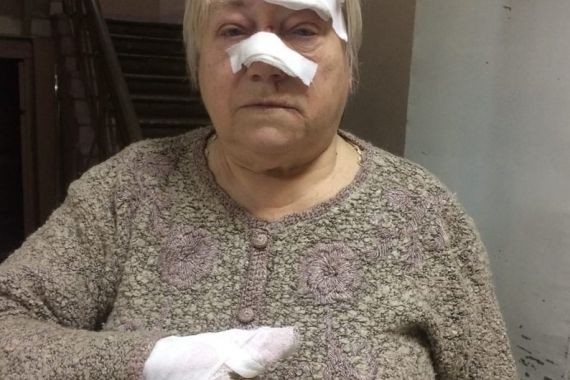 В Твери на 75-летнюю женщину упала крыша остановки. Пенсионерку отправили в больницу пешком