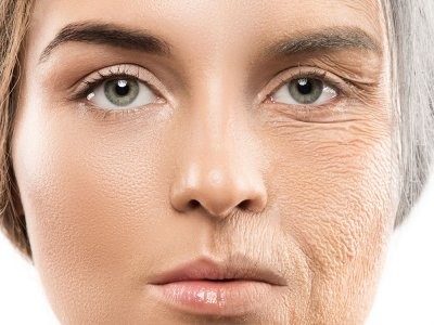 Врач назвала гормоны, из-за которых женщины стареют раньше времени