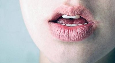 Врач рассказала, о каких болезнях может предупреждать сухость во рту