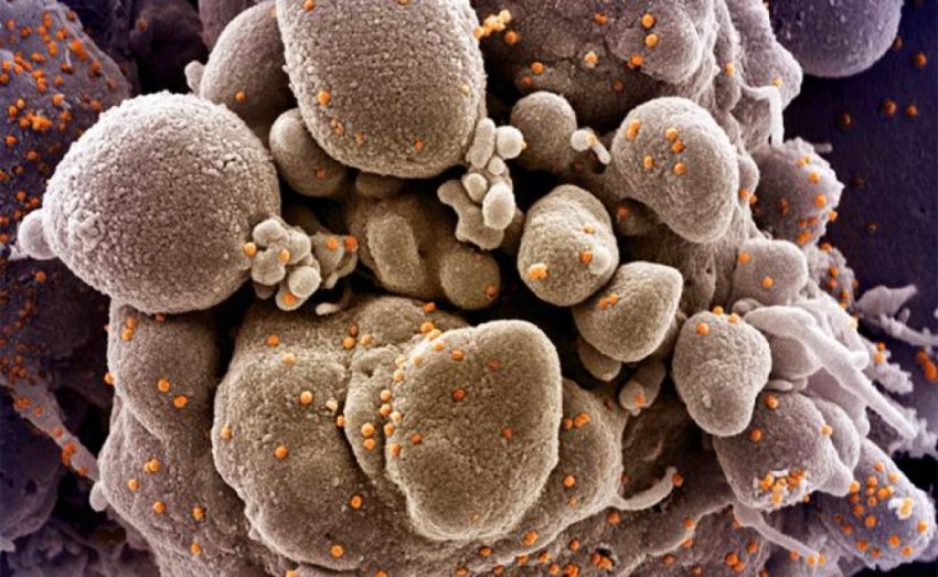 Геополитический аналитик: COVID-19 создан искусственно для управления миром