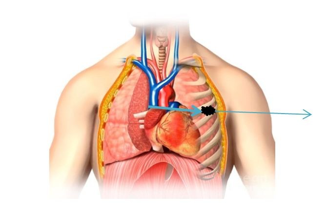 Самоубийство Маяковского оказалось случайным выстрелом Самоубийство Маяковского оказалось случайным выстрелом