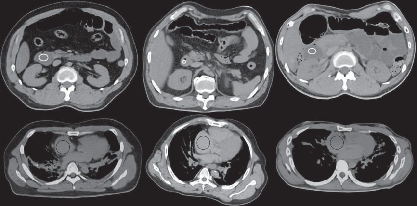 Блюда, которые могут оборвать не только праздник, но и жизнь