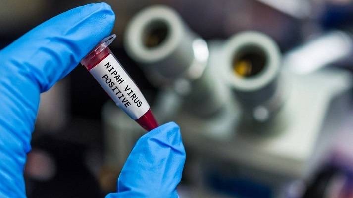 Что можно ожидать в 2021 году от вируса Nipah, вспышки которого фиксируются в странах Азии