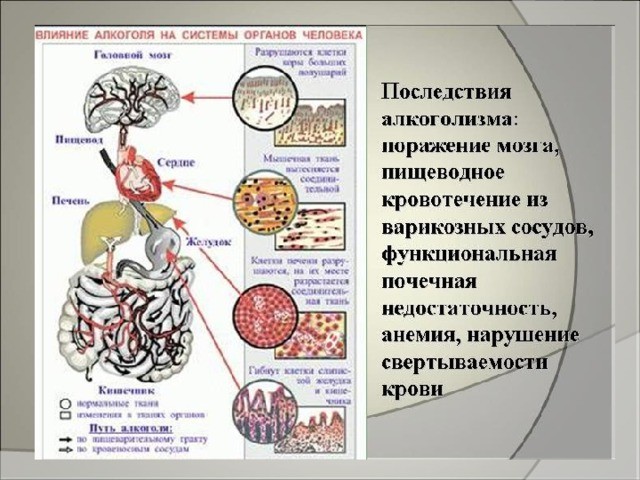 Как алкоголь влияет на здоровье и эмоциональное состояние человека
