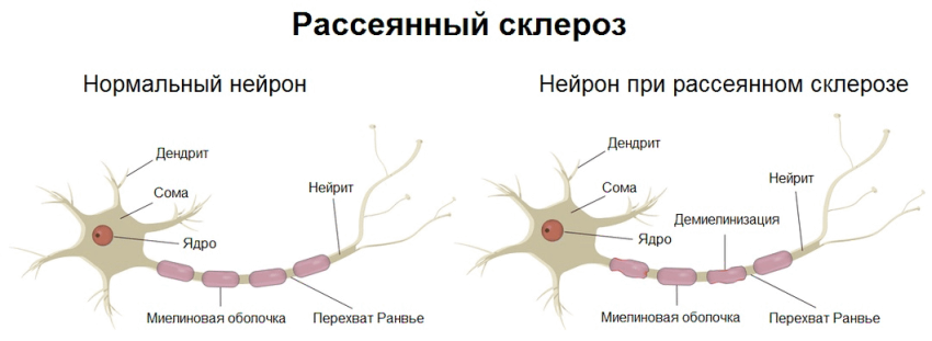 Какой праздник сегодня, 11 июня, отмечают в разных странах мира