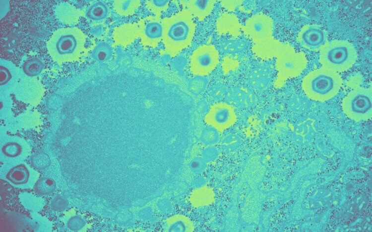 Вирус Нипах: эксперты говорят об угрозе новой пандемии